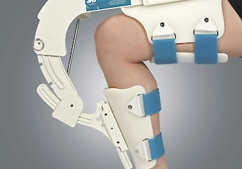 Orthopedics