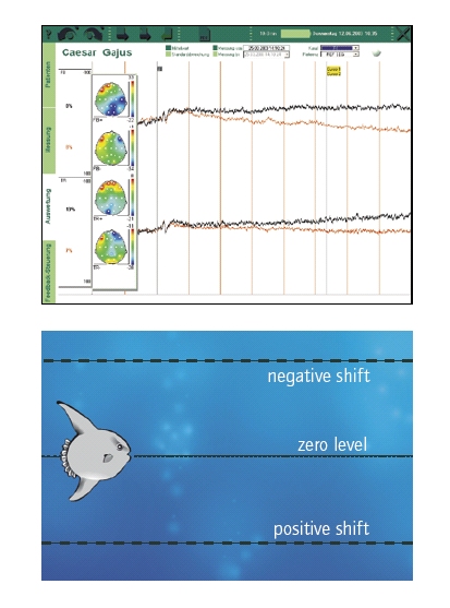 neuroCare - THERA PRAX MOBILE DC - EEG 生物反饋系統